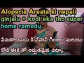 పేనుకొరుకుడుకి నేపాలీ గింజలు కోడి ఈక