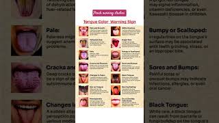 Warning signs: Tongue colour