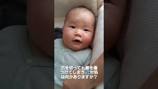 顔をひっかいてしまう💦ミトンと爪切り以外にいい案ありますか？
