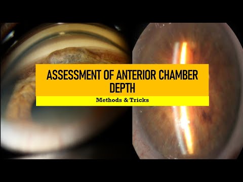 ANGLE DEPTH ASSESSMENT and GRADING | Van Herrick, smith, pen torch, limbal split technique and more