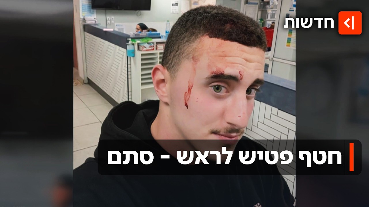 פטיש לראש מול המצלמות: נערים שברו את הגולגולת של מאור וברחו בלי להיתפס