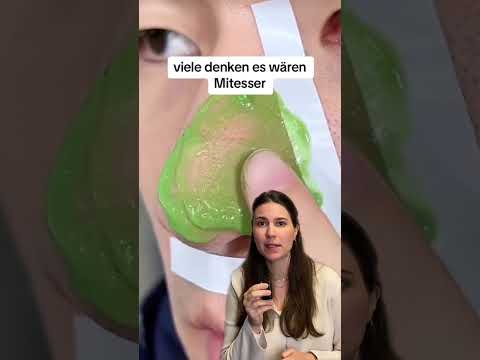 Blackheads or follicle filaments? 🤔 #dermatologist #dermatologistperapp #skincare #blackheads