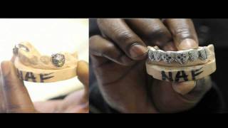 Greezie Tv - Naf Skrilla Spends Over 7k On Two Sets Of Grillz (Blue Cheese Family)