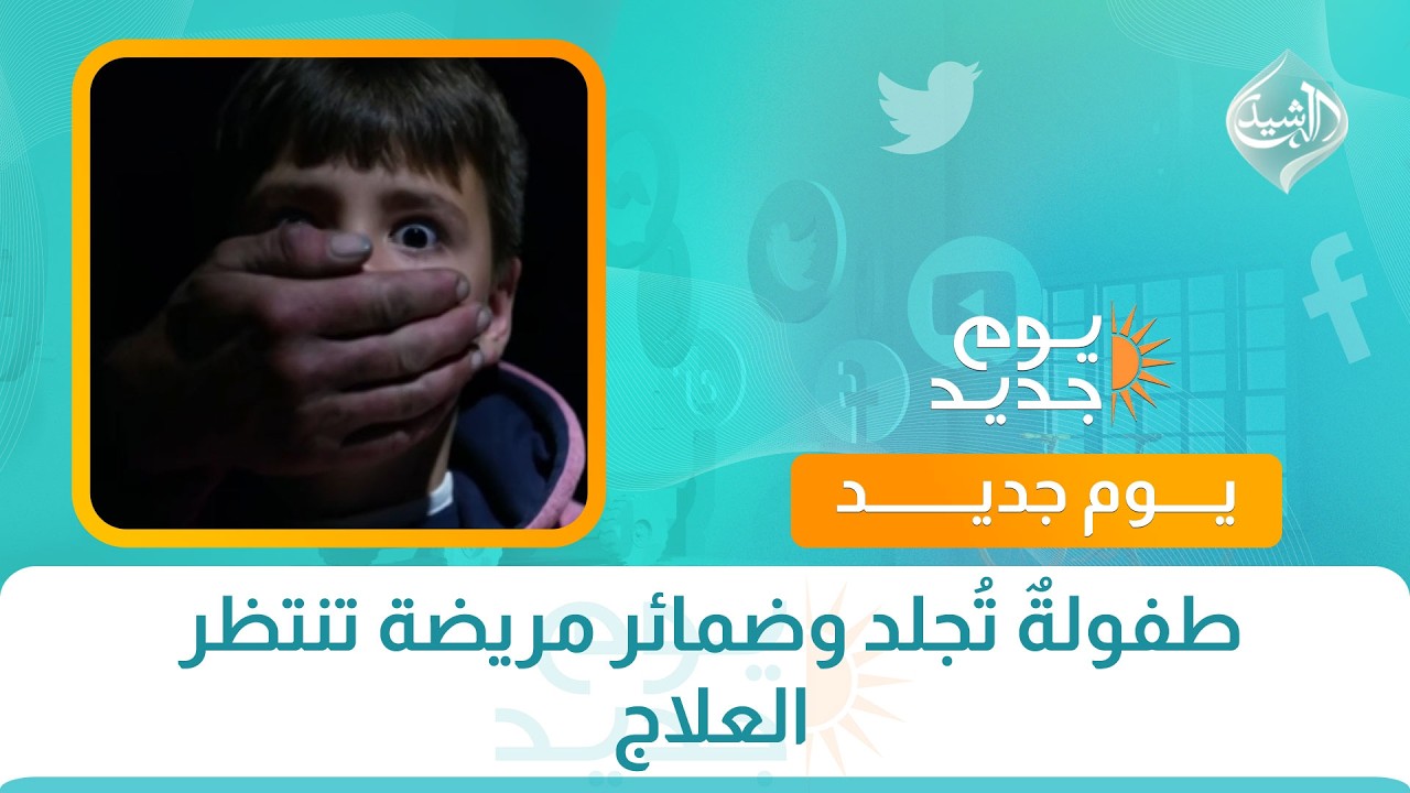 فيديو | طفولةٌ تُجلد وضمائر مريضة تنتظر العلاج