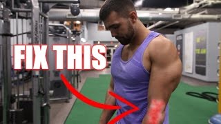 Fix Tennis Elbow Pain Now- How To Treat Tendonitis Naturally (6 QUICK TIPS)