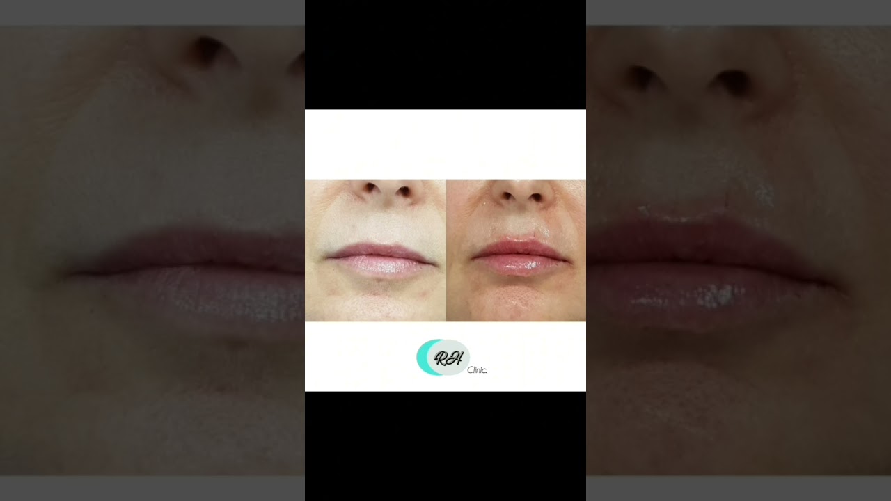 Rosalba Herrero Zerpa-637