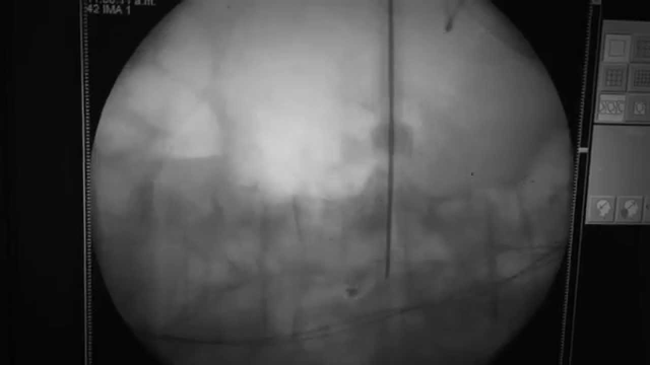 Enrique De Obieta Cruz-51