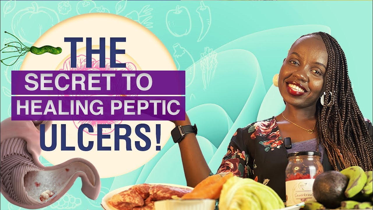 How I Healed My Peptic Ulcers - Health Versations Video Guide