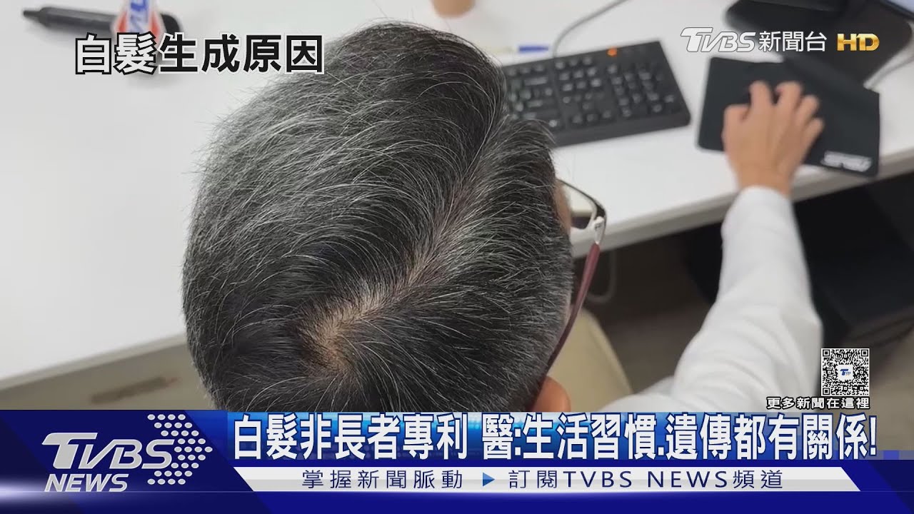 年輕人白髮暴增?醫揭五大原因 會害黑髮變少!
