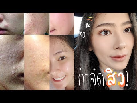 ความแข็งแรงหัวใจอ่อนแอ กว่าหล่นอันตรายค้อนของ ธ อร์