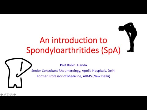 Professor Rohini Handa discusses the concept of Spondyloarthritides