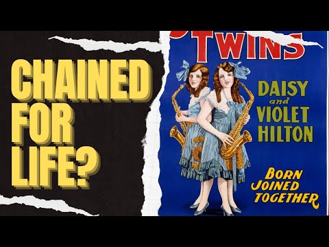 The conjoined Hilton Sisters and their surprisingly uplifting story