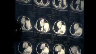 Surgical Radiology - 7 - Basics of MRI & CT Review 2