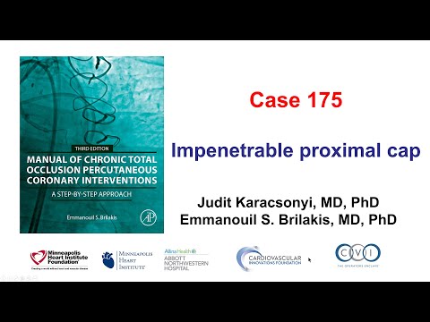 Case 175: Manual of CTO PCI - Impenetrable proximal cap