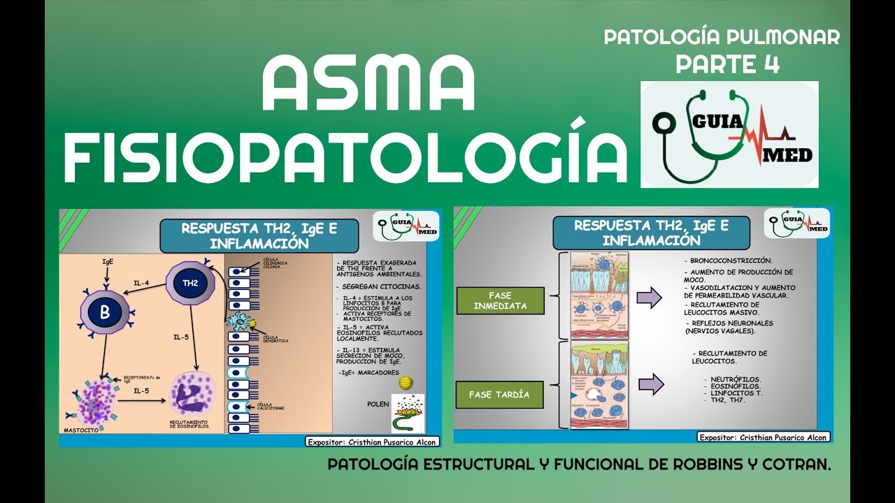 ASMA BRONQUIAL FISIOPATOLOGÍA | GuiaMed
