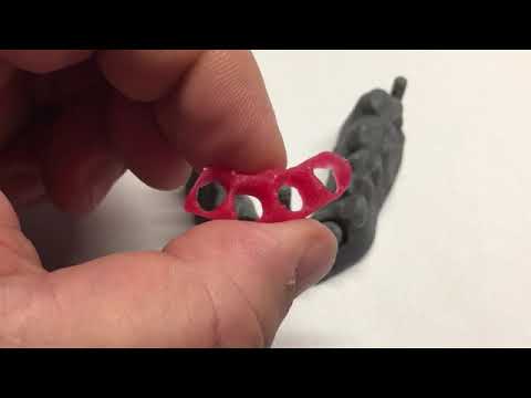 gedruckte Zahnfleischmaske