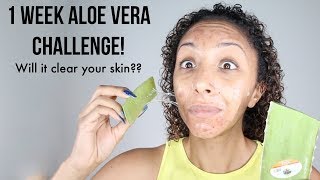 1 WEEK ALOE VERA CHALLENGE! REAL RESULTS! Will it clear acne and fade scars?? | BiancaReneeToday