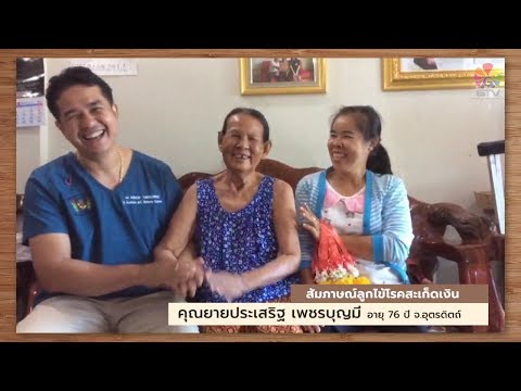 ถูกแทนที่ด้วย methotrexate ในโรคสะเก็ดเงิน ล้างโรคสะเก็ดเงิน