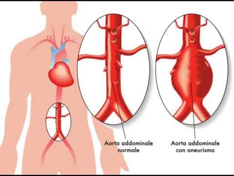 Articolazioni gonfie ai gomiti Ciò che i preparativi per dolori articolari