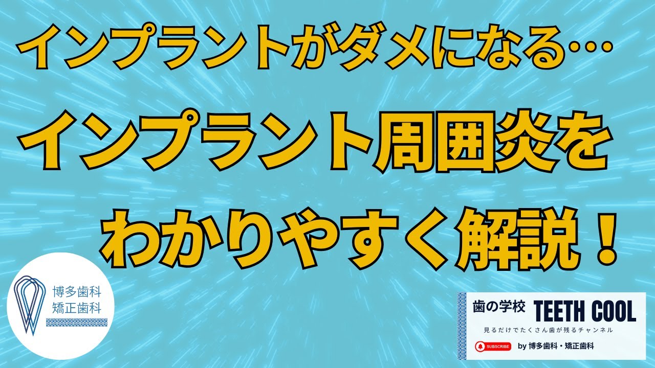 インプラントの歯周病【インプラント周囲炎】インプラントがダメになる前に知っておきたいこと