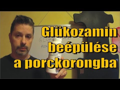 Artrózis klinika és kezelés