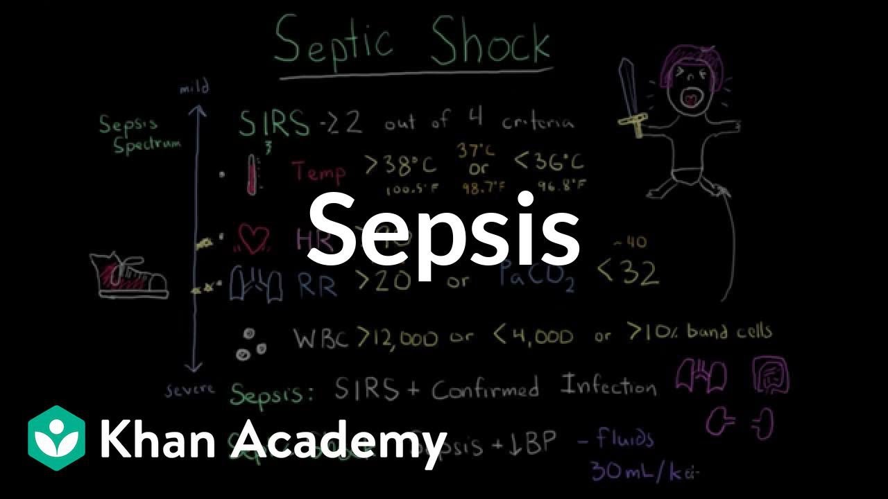 Sepsis: Systemic inflammatory response syndrome (SIRS) to multiple organ dysfunction syndrome (MODS)