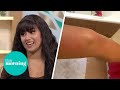 Woman Allergic To Water Can T Have A Shower Without Sparking Physical Agony This Morning