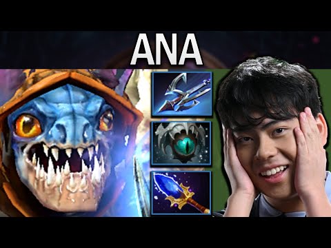 Slark Dota 2 7.34 Gameplay Ana with 20 Kills - Skadi