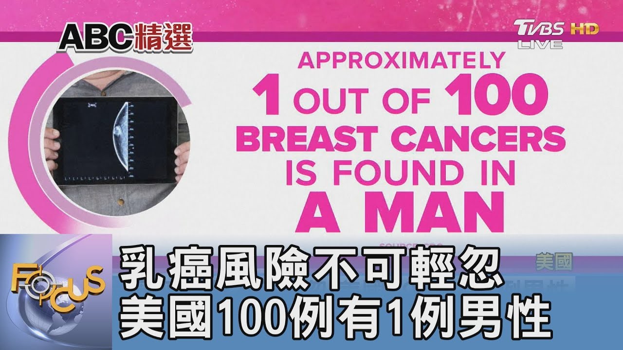 乳癌風險不可輕忽 美國100例有1例男性