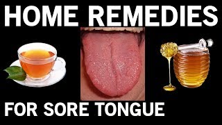 Best 6 Home Remedies for Sore Tongue