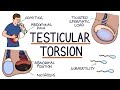 Understanding Testicular Torsion