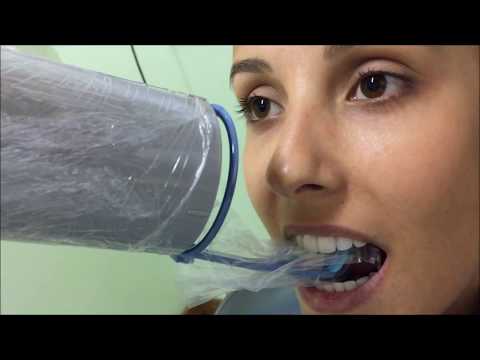 Radiografia Periapical com Posicionadores - Maxila Anterior