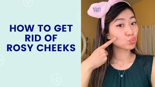 How To Get Rid of Rosy Cheeks | FaceTory