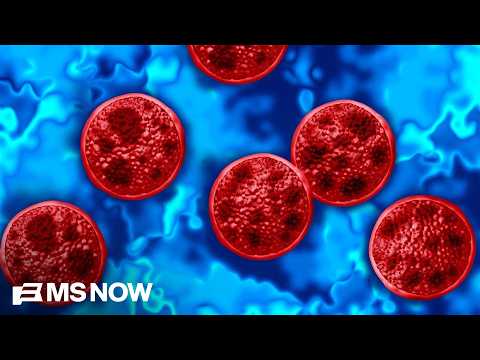 Outbreak of intestinal illness Cyclospora hits the U.S.