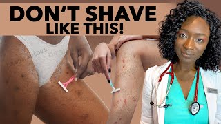 These SHAVING MISTAKES Are Damaging Your Skin | Avoid Razor Burn, Ingrown Hair, Irritation