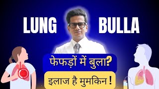 Bullous Lung Disease क्या है? फेफड़ों में बुला? इलाज और ऑपरेशन | Dr Kamran Ali