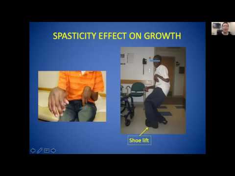Spasticity Medical Management for Individuals with Cerebral Palsy: Non Surgical - Dr. Heakyung Kim
