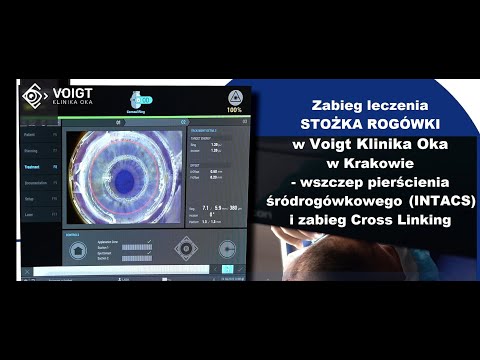 Leczenie Stożka Rogówki - zabieg INTACS i Cross Linking w Voigt Klinika Oka w Krakowie