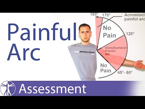 Painful Arc Syndrome | Shoulder Impingement