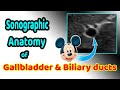 Sonographic anatomy of the gallbladder and biliary ducts