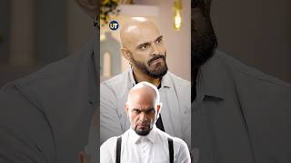 Hair fall Made Him Go Bald😧