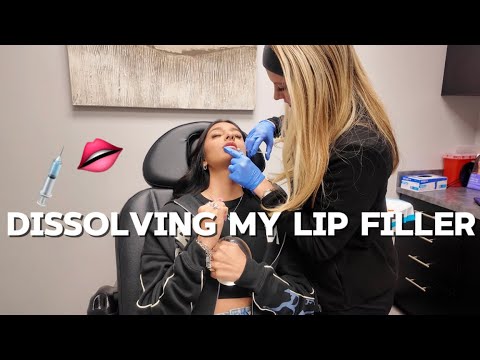 VLOGMAS #22: I dissolved my lip filler…. 👄💉 TW:NEEDLES