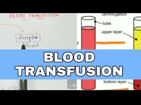 Typhoid fever Salmonella typhi Causes symptoms diagnosis treatment Bio science