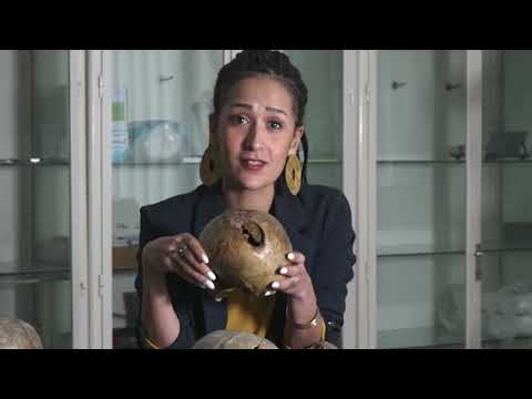 Perimortem or Postmortem Fractures? Introduction to Trauma