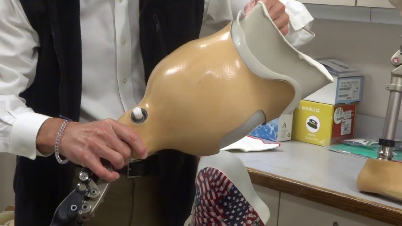 Lower Limb Prosthetics - AKA Socket Design w/ Doctor U Wanna Know (ep. 5)