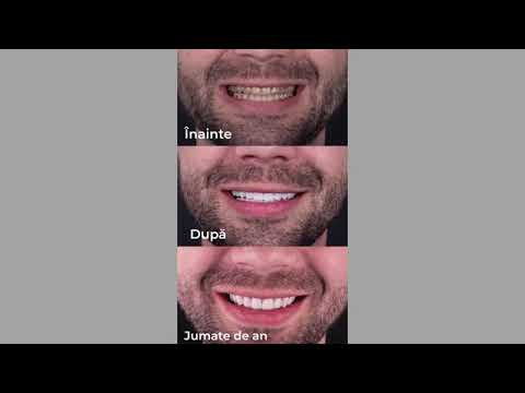 Interviu la emisiunea Lifestyle Sănătate Romaniuc Dumitru