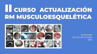 Dr. Luis Pérez Carro - Actualización en artroscopia del codo