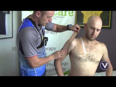 Taping Techniques 4.0 How to tape a Shoulder for an AC Joint