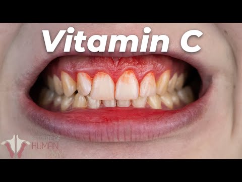 This is Why You Need Vitamin C Everyday