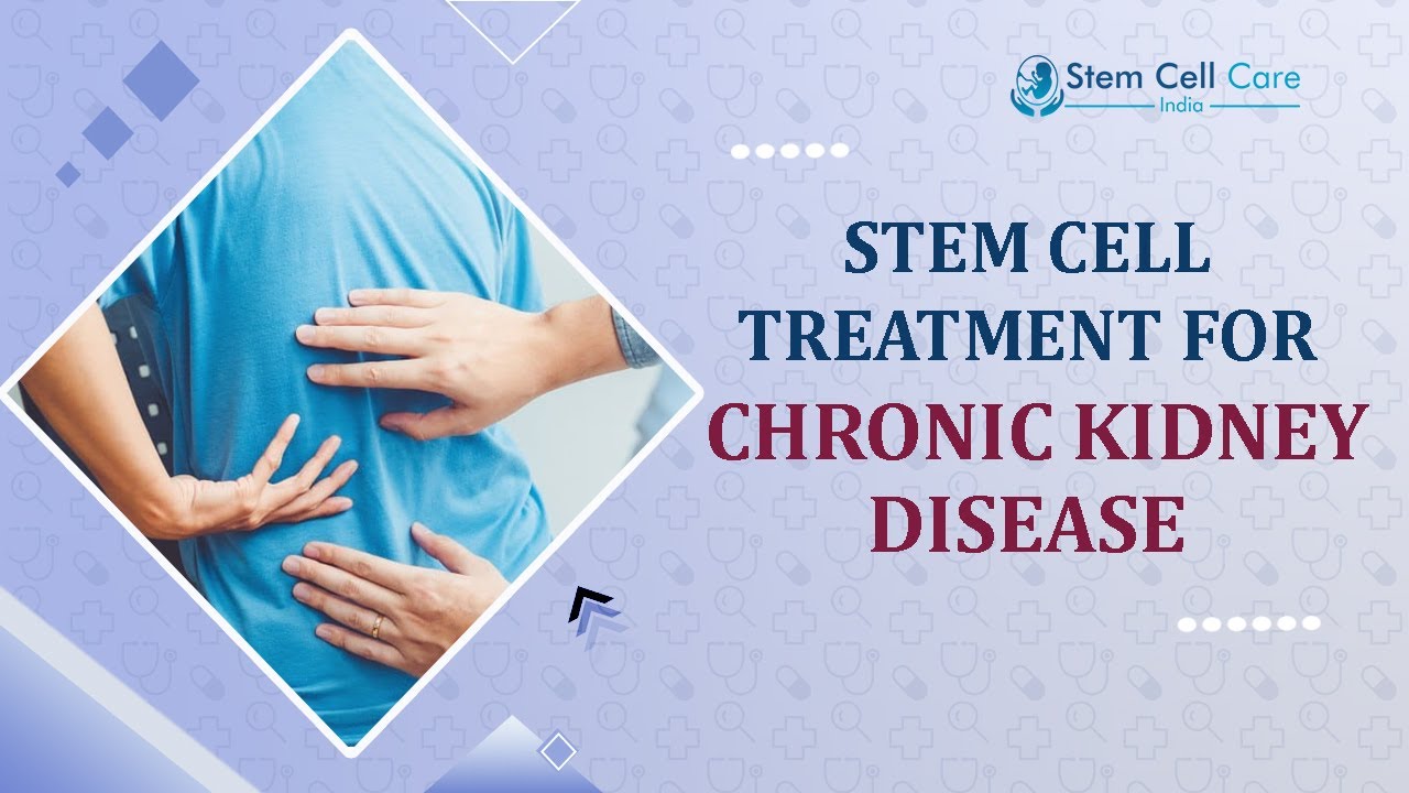 Chronic Kidney Disease | Stem Cell Therapy For Chronic Kidney Disease | CKD | Stem Cell Treatment